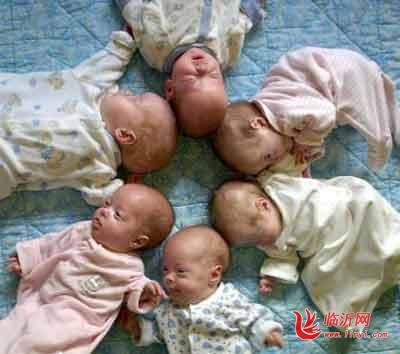 八胞胎事件